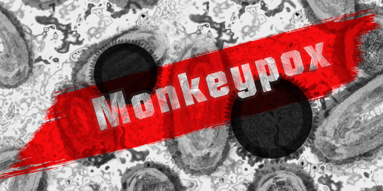 NC Health Officials Warn Of Increased Mpox (Monkeypox) Cases Statewide